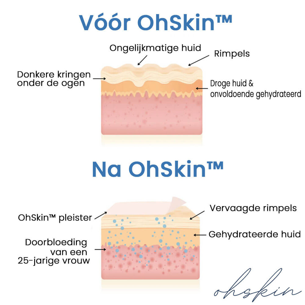 Herbruikbare Anti-Rimpelpleisters
